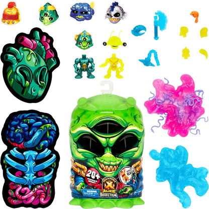 Moose Toys - Treasure X: Alien Autopsie (Medium - 20+ Überraschungen)